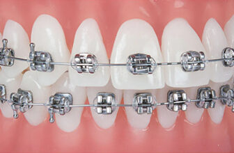 Thay dầu hộp số CRV: Nhận biết sớm 7 dấu hiệu và cách chọn đúng loại dầu cho từng đời xe